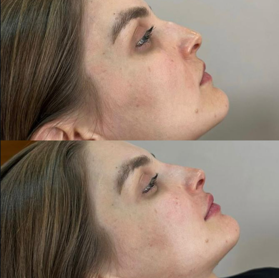 Facial harmonization